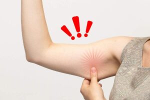 Controllo dei muscoli delle braccia